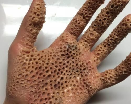 Trifobik desenler gösteriyorlar ya heh onlar benim çok hoşuma gidiyor benjm gibi olan var mı?