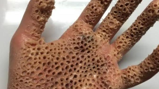 Trifobik desenler gösteriyorlar ya heh onlar benim çok hoşuma gidiyor benjm gibi olan var mı?