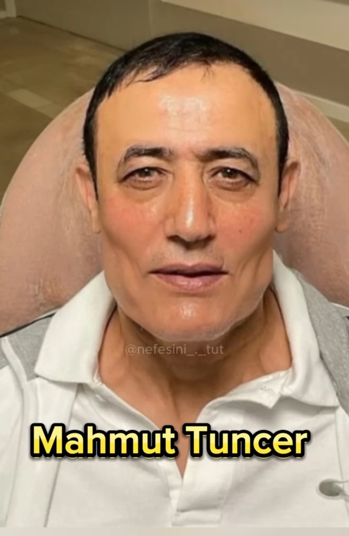 Estetikten sonraki son halleri için görüşünüz?
