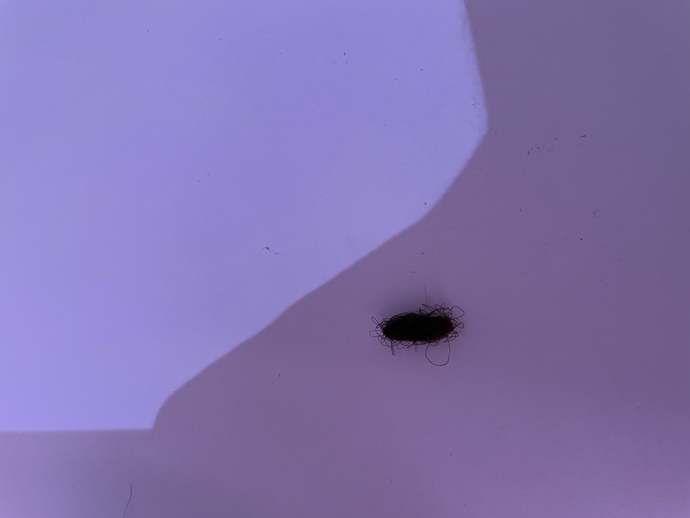 Saçlarımı banyodan sonra taradım bu kadar döküldü normal mi?
