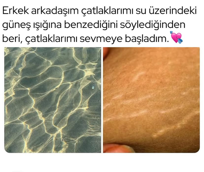 Sevdiğinizin kusurlarını da sever misiniz?