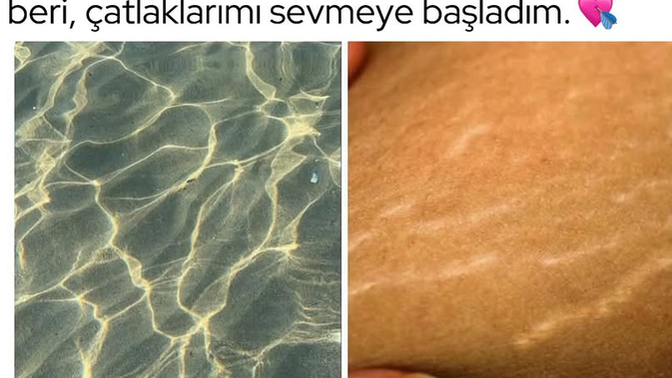 Sevdiğinizin kusurlarını da sever misiniz?