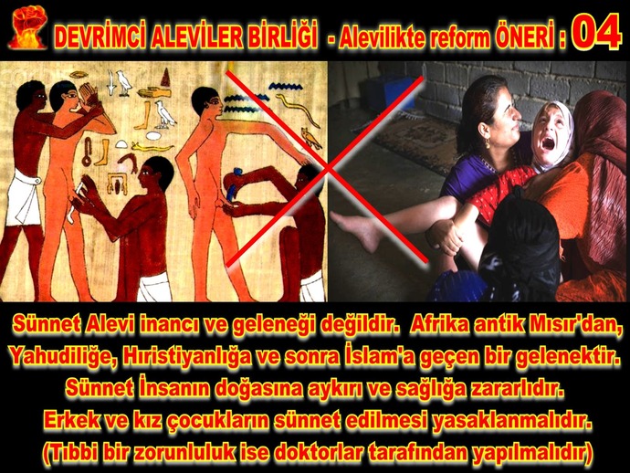 Sünnet düğünü denilen şey saçma değil mi?