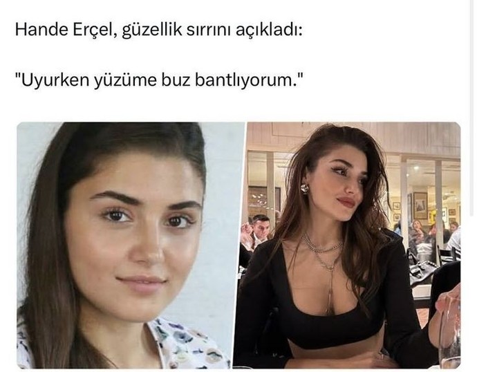 Yüzümü buz bantlayıp uyusam estetik etkisi verir mi xdkdkd?