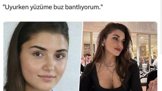 Yüzümü buz bantlayıp uyusam estetik etkisi verir mi xdkdkd?