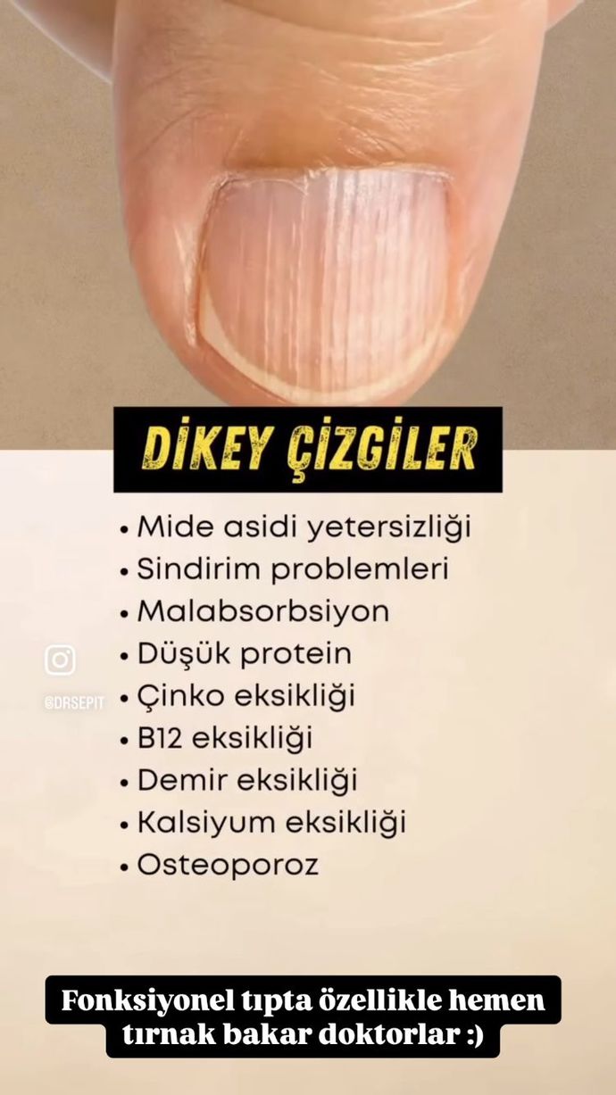 Baksam Ne olduğu Tırnağından Bile Bilirim? Siz de Tırnağınıza Baktınız mı?