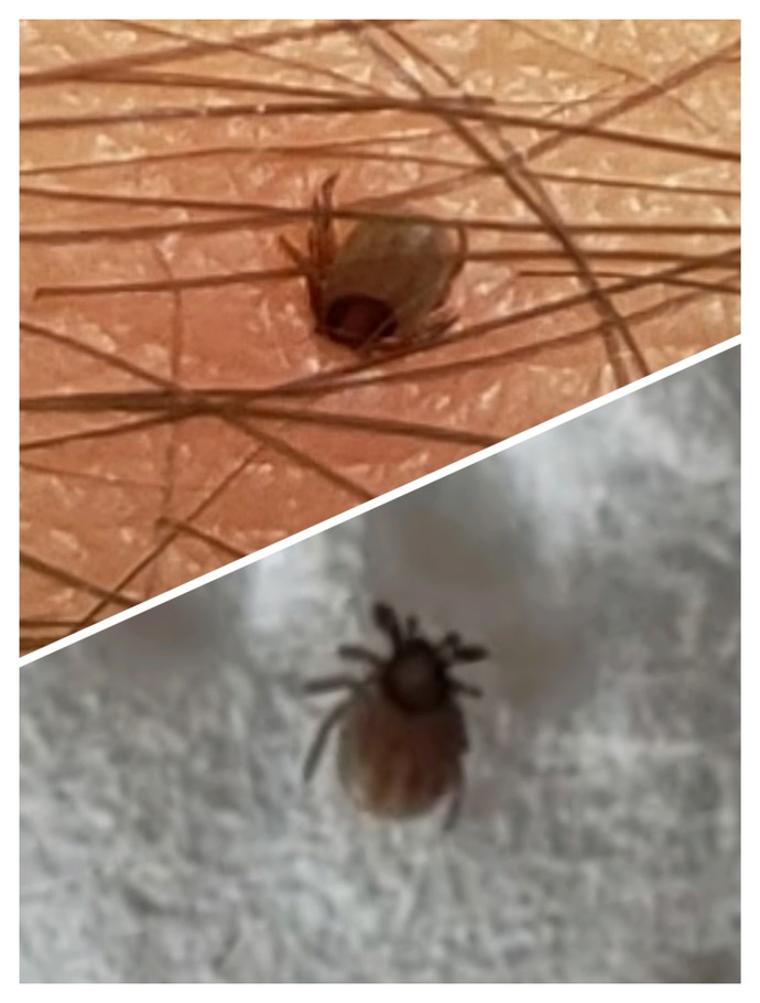 Hayatınızdaki kan emicilerle nasıl mücadele ediyorsunuz onlardan nasıl kurtuluyorsunuz?