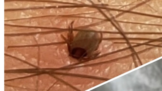 Hayatınızdaki kan emicilerle nasıl mücadele ediyorsunuz onlardan nasıl kurtuluyorsunuz?