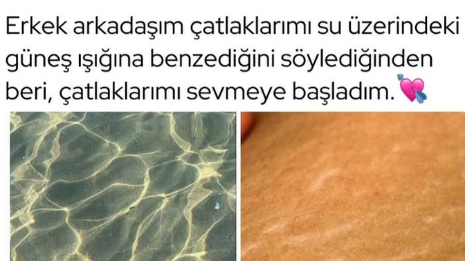 Aşk insanı kendine bile aşık eder mi?