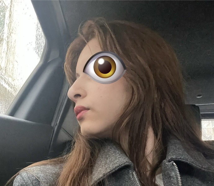 Kızlar burun takıntım var çok mu kötü?
