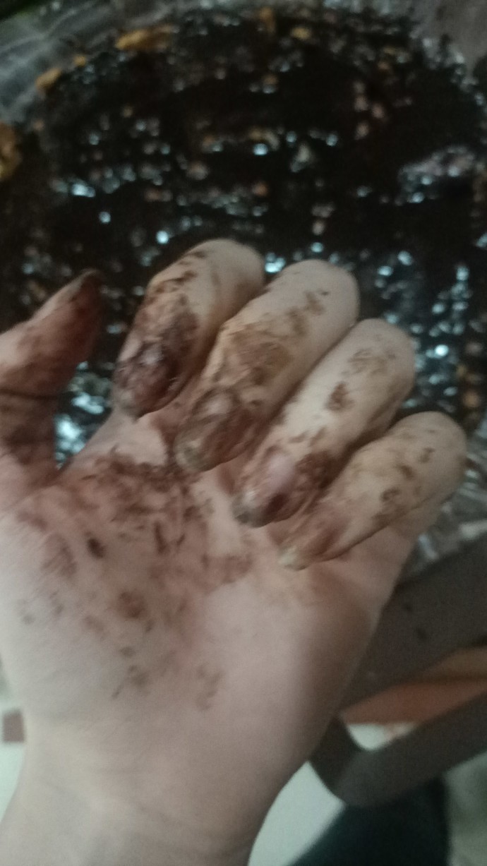zehirleniicizzz ngsngs