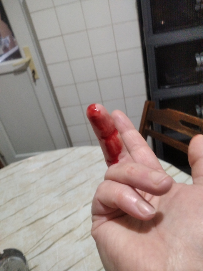 Burada ölsek haberiniz olmayacak öyle dimi?
