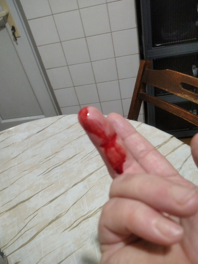 Burada ölsek haberiniz olmayacak öyle dimi?