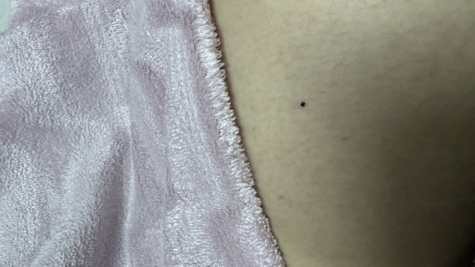 Bacağımda birden bire böyle bir şey oluştu ben mi bu nedir tehlikeli mi?