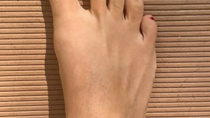 Bana çirkin ayaklı dedi ayağım çirkin mi?