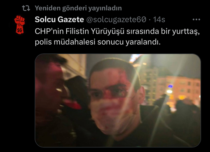 Akpnin derdinin filistin olmadığını anladınız mı?