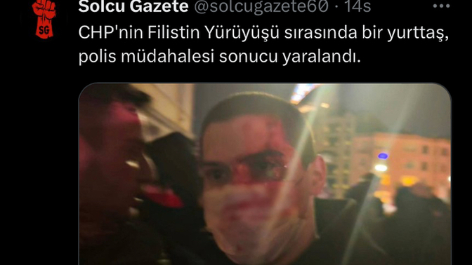 Akpnin derdinin filistin olmadığını anladınız mı?