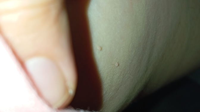 Kolumun alt kısmında böyle minik bi şeyler çıktı bu nedir?