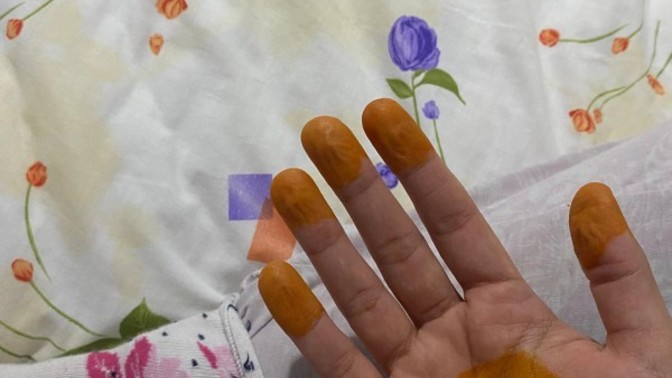 Elime kına yaktım ama turuncu oldu, kırmızı olmadı. Nasıl gider bu ya?