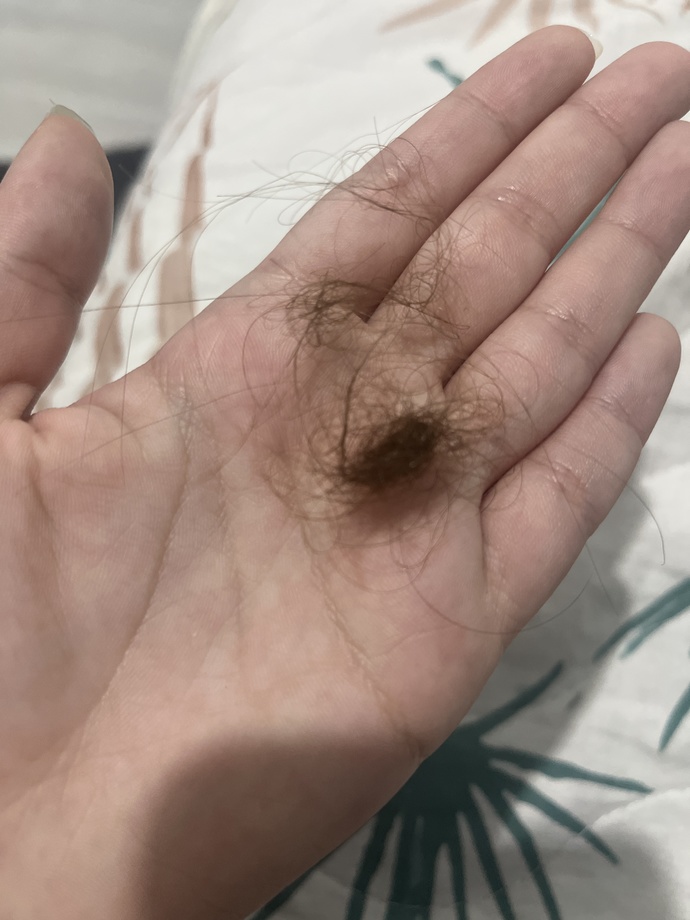 Bu kadar dökülmesi normal mi?