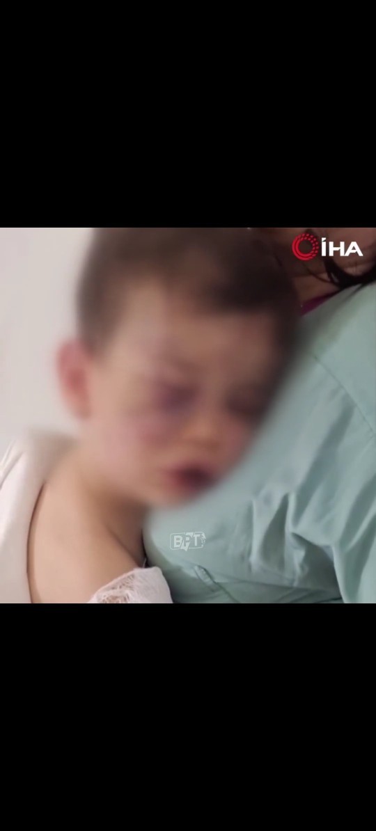 Annesinin erkek arkadaşları tarafından öldüresiye darp edilen çocuk?