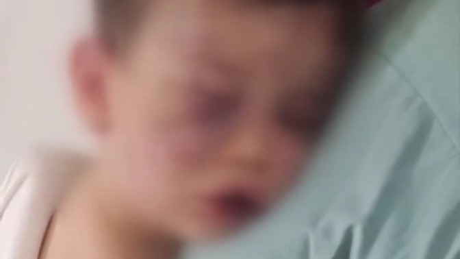 Annesinin erkek arkadaşları tarafından öldüresiye darp edilen çocuk?