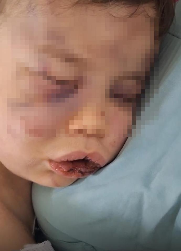 Denizli’de 2 Yaşındaki Bebek Dövülerek Hastanelik Edildi! Nasıl bir vicdan, bir bebeğe bunu yapabilir?