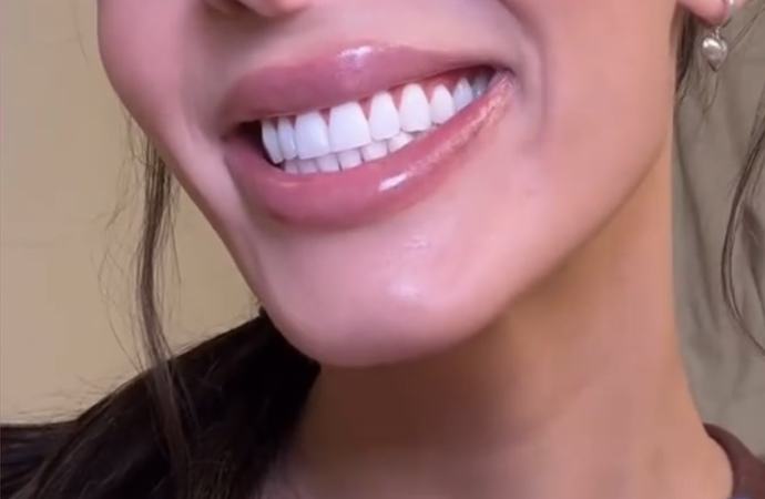 Dişler size çekici gelir mi?