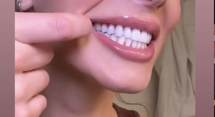 Dişler size çekici gelir mi?