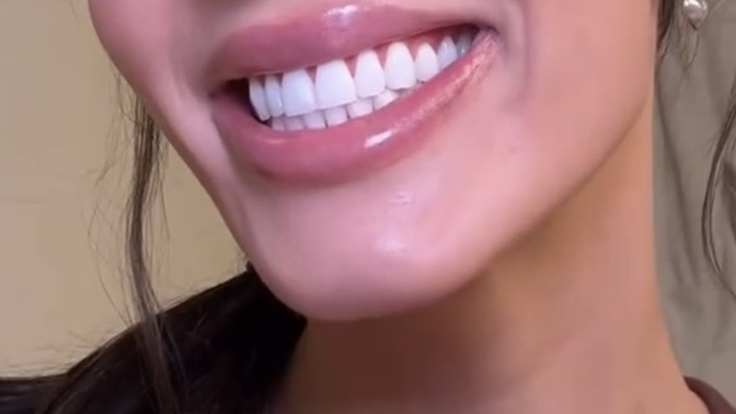 Dişler size çekici gelir mi?