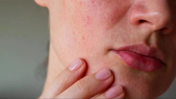 Makyaj malzemeleri hiç cildinizde alerji falan yaptı mı?