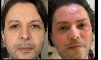 Nihat doğanın yeni halini nasıl buldunuz?