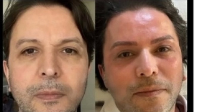 Nihat doğan'ın yeni halini nasıl buldunuz?