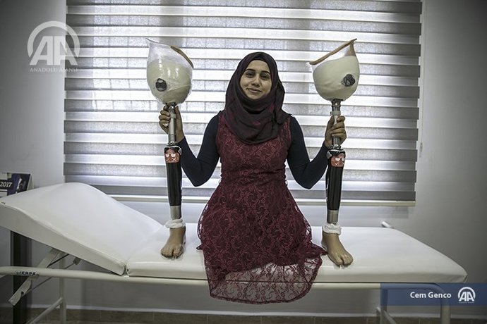 Türkiye'de bedava protez bacağa sahip olan Suriyeli kadın
