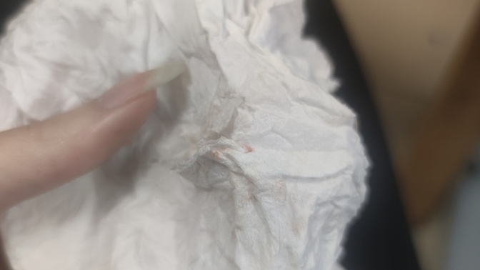 Ya çok yüksek sesle çığlık attım bağırdım ağladım hafif burnum kanadı bişey olur mu?