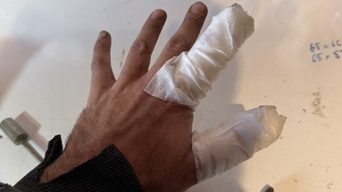 En son nasıl yaralandınız? Sizide benim gibi kan tutuyor mu?