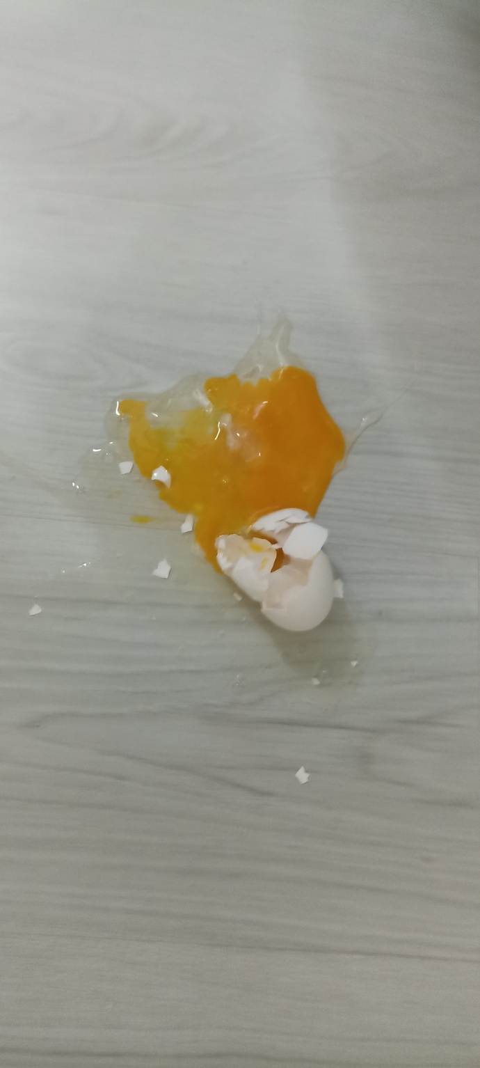 Hiç böyle bir kaza başınıza geldi mi?