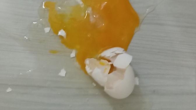 Hiç böyle bir kaza başınıza geldi mi?