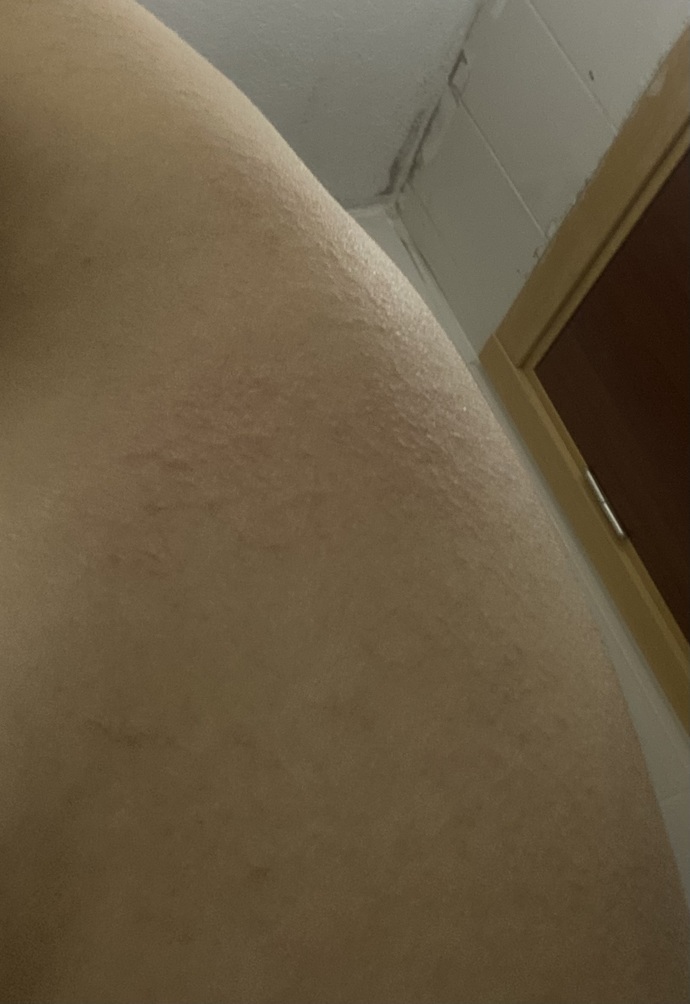 Bugün vücudumda bunları fark ettim ve kaşınıyor, sebebi ne olabilir? Detayı okur musunuz?