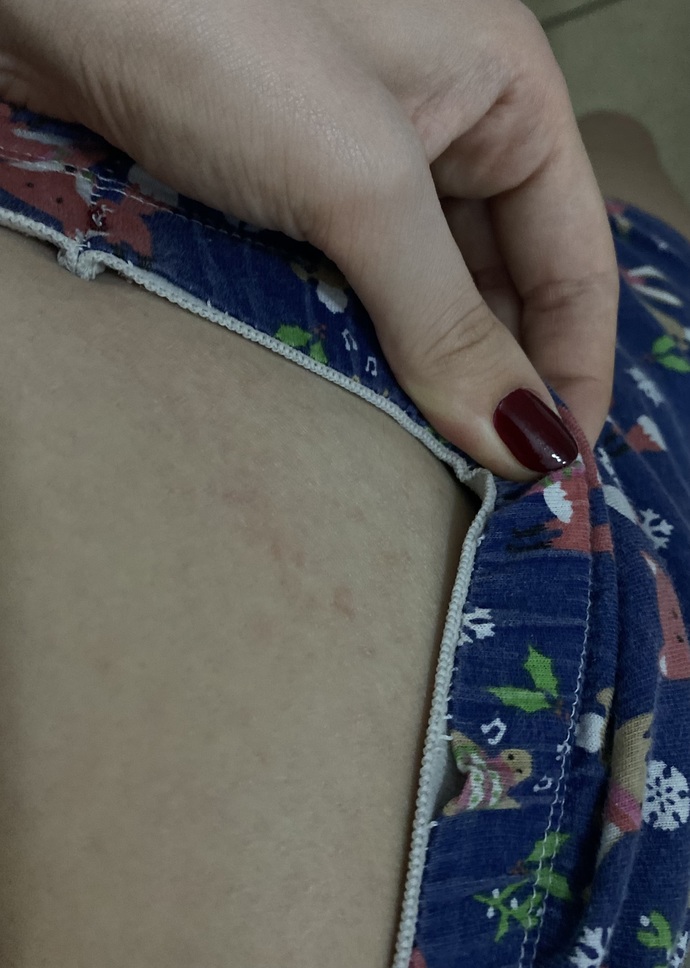 Bugün vücudumda bunları fark ettim ve kaşınıyor, sebebi ne olabilir? Detayı okur musunuz?