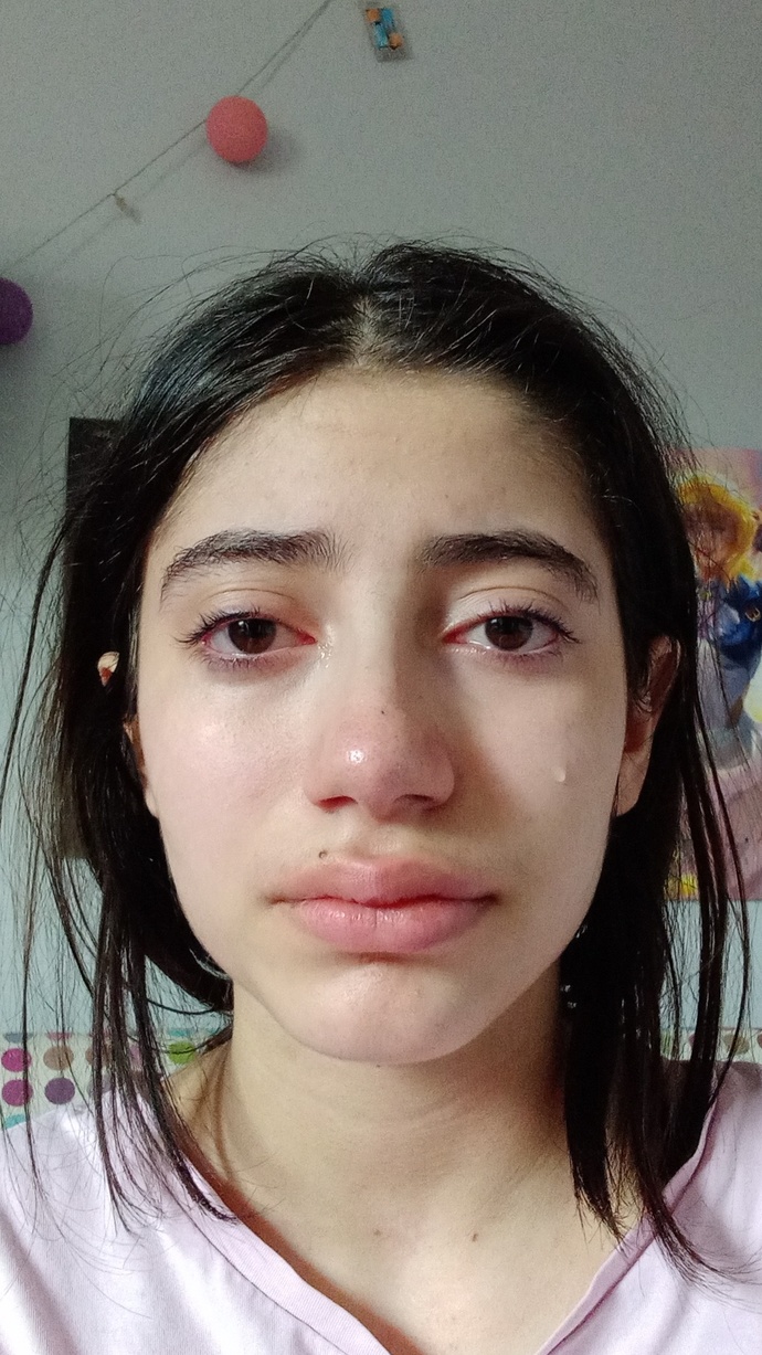 Dişim çok feci ağrıyor nolur yardım edin lütfen?