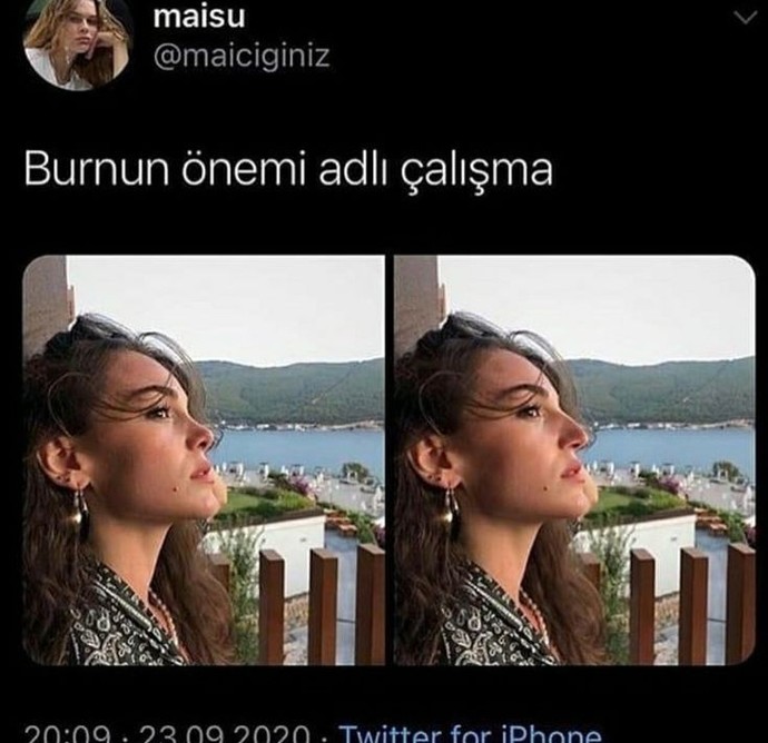 Burnunuz güzel mi?