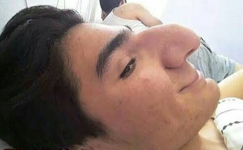 Burnunuz güzel mi?