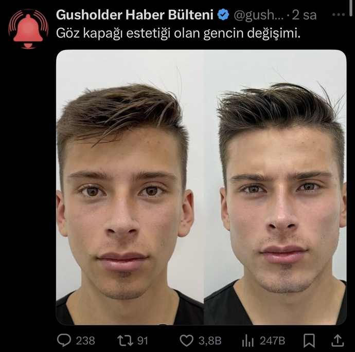 Erkek adam estetik yaptırır mı?