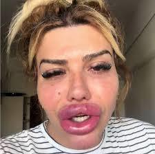 Estetik yaptırmak size itici veya yapay geliyor mu?