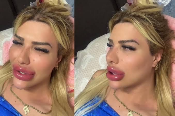 Estetik yaptırmak size itici veya yapay geliyor mu?