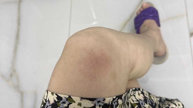Ayağıma kuş sıçtı bacağimi köpek ısırdı sjssjj?