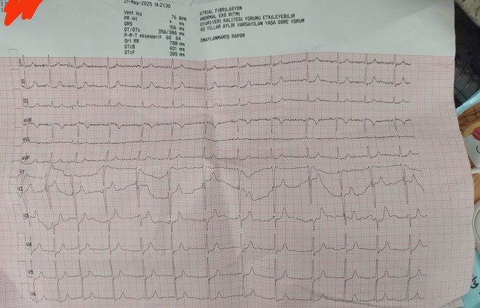 Acilde göğsüm ağrıyor diye EKG istediler bir karfiyolojiye görünebilirsin dedi?