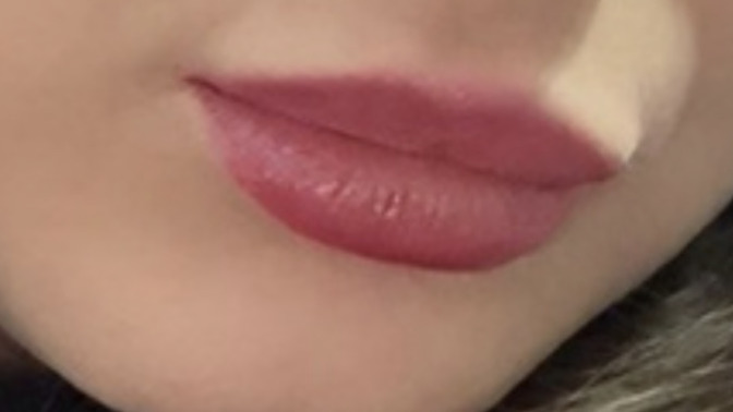 Dudağımda dolgu olduğu anlaşılıyor mu?
