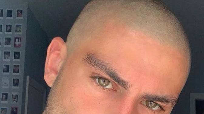 Saçsız erkek çekici mi?